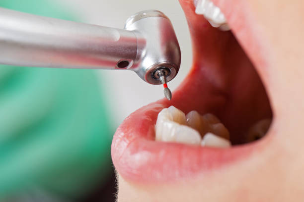 Best Emergency Denture Repair in Richmond, MI